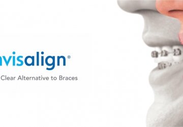 Αξιολόγηση της μεθόδου INVISALIGN μετά από 15 χρόνια προσωπικής εφαρμογής